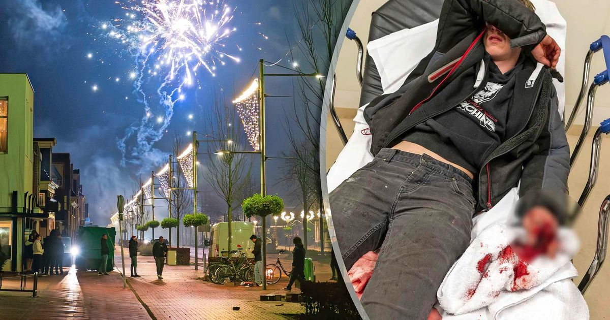 Meer jongeren onder zestien jaar door vuurwerk op spoedeisende hulp: ’Impact van lokaal verbod is beperkt’